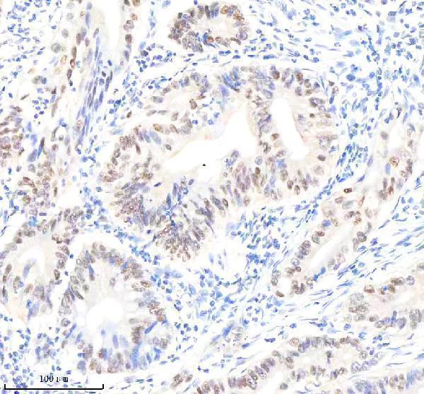 m03720 pold1 primary antibodies ihc testing 4