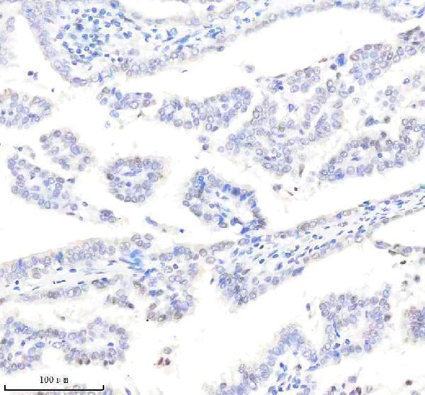 m03720 pold1 primary antibodies ihc testing 5