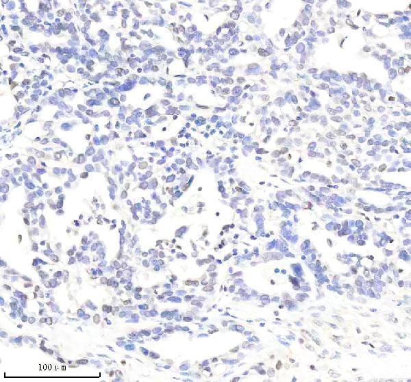 m03720 pold1 primary antibodies ihc testing 6