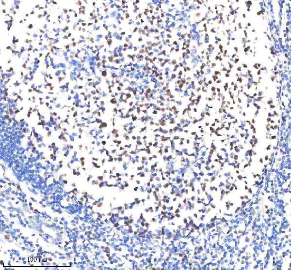 m03720 pold1 primary antibodies ihc testing 7