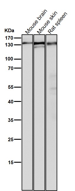 All lanes use the Antibody at 1:5K dilution for 1 hour at room temperature