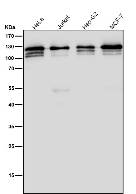 All lanes use the Antibody at 1:5K dilution for 1 hour at room temperature