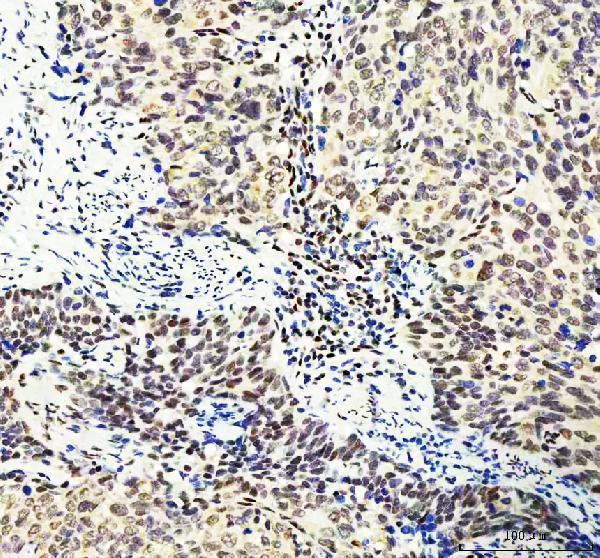 m03727 2 ddx1 primary antibodies ihc testing 2_1
