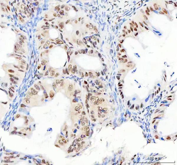m03727 2 ddx1 primary antibodies ihc testing 3_1