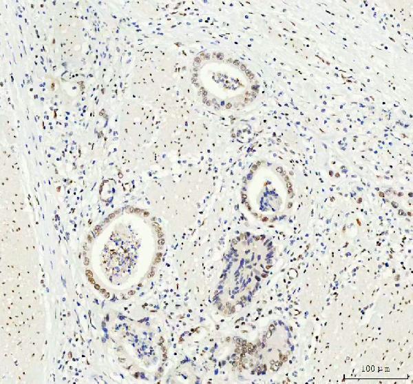 m03727 2 ddx1 primary antibodies ihc testing 4_1