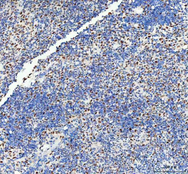 m03727 2 ddx1 primary antibodies ihc testing 5