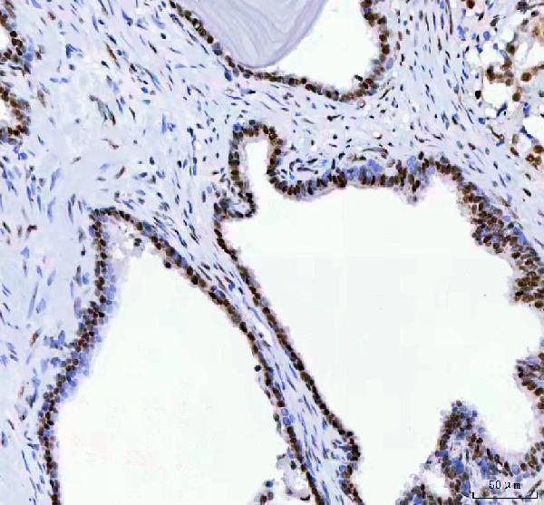 m03727 2 ddx1 primary antibodies ihc testing 6