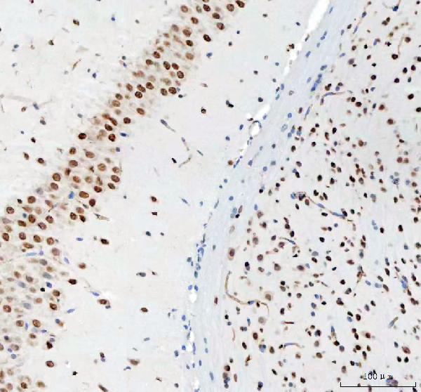 m03727 2 ddx1 primary antibodies ihc testing 7