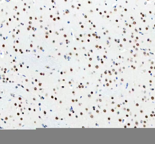 m03727 2 ddx1 primary antibodies ihc testing 8