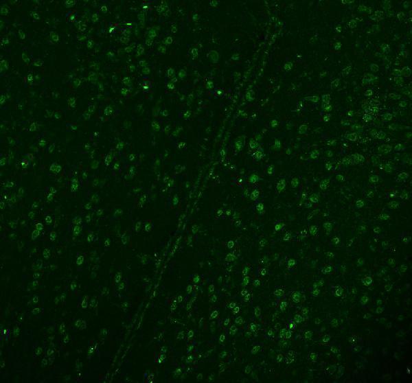 m03727 ddx1 primary antibodies if testing 12