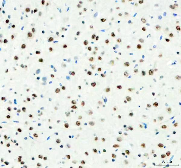 m03727 ddx1 primary antibodies ihc testing 10