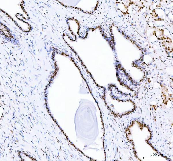 m03727 ddx1 primary antibodies ihc testing 2_1