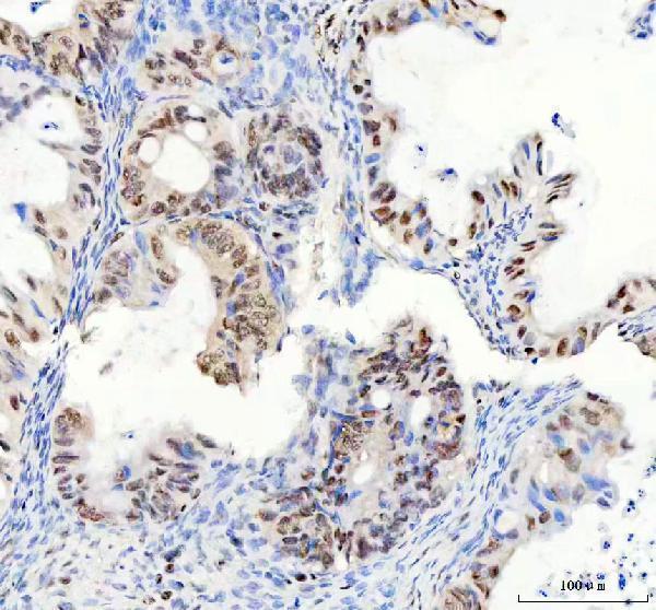 m03727 ddx1 primary antibodies ihc testing 4_1