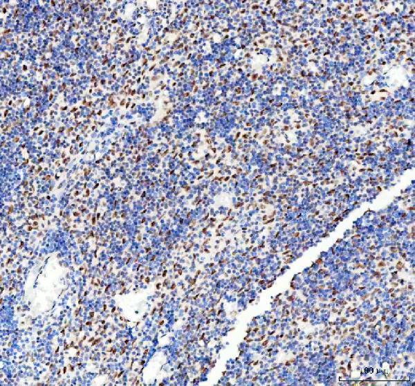 m03727 ddx1 primary antibodies ihc testing 5_1