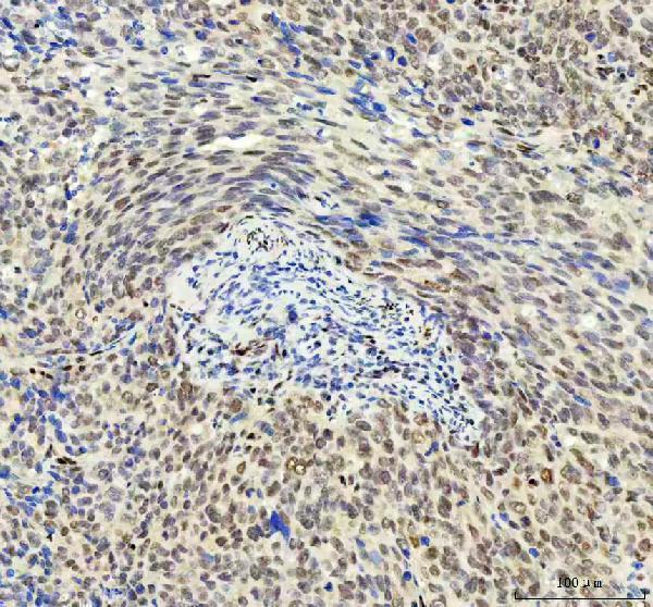 m03727 ddx1 primary antibodies ihc testing 6_1