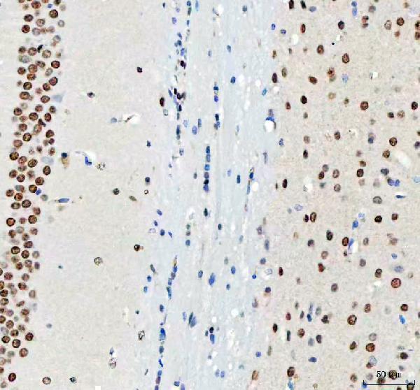 m03727 ddx1 primary antibodies ihc testing 7_1