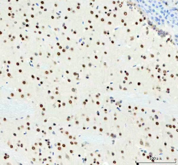 m03727 ddx1 primary antibodies ihc testing 9_1