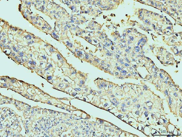  IHC analysis of Annexin VI using anti-Annexin VI antibody (M03735-1)