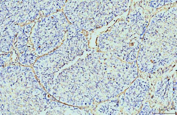  IHC analysis of Annexin VI using anti-Annexin VI antibody (M03735-1)