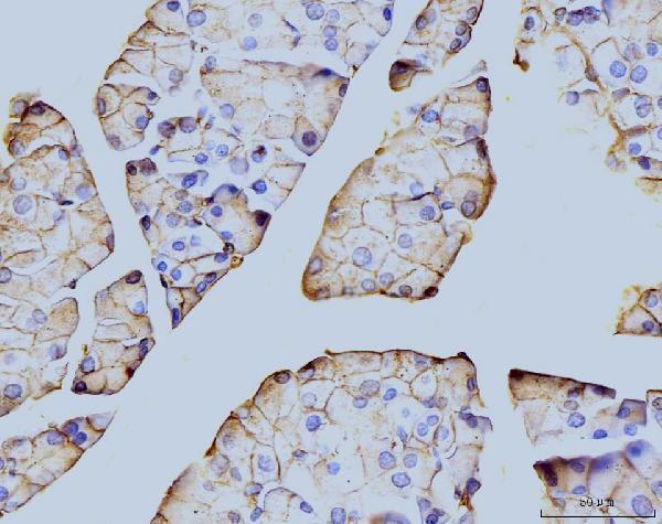 m03735 1 anax6 primary antibodies ihc testing 5