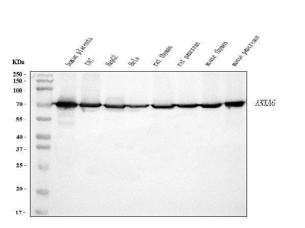  Western blot analysis of Annexin VI using anti-Annexin VI antibody (M03735-1)