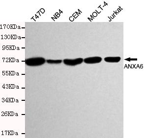 Western blot detection of ANXA6 in T47D, MB4, CEM, MOLT-4 &Jurkat cell lysates and using ANXA6 antibody (1:1000 diluted) 