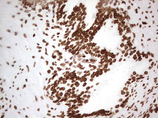 m03736 anti hset1 setd1a mouse monoclonal antibody clone id oti7b7 ihc testing 2