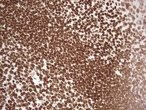 m03736 anti hset1 setd1a mouse monoclonal antibody clone id oti7b7 ihc testing 3