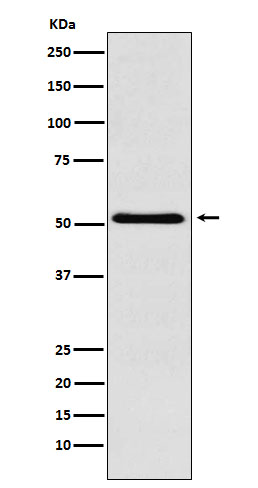 Western blot analysis of BAF57/SMARCE1 expression in Raji cell lysate