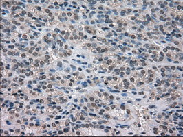 m03740 anti nek6 mouse monoclonal antibody clone id oti5d7 ihc testing 5