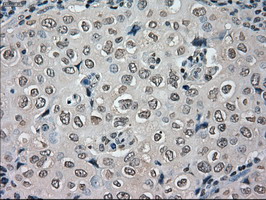 m03740 anti nek6 mouse monoclonal antibody clone id oti5d7 ihc testing 7