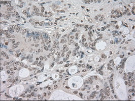m03740 anti nek6 mouse monoclonal antibody clone id oti5d7 ihc testing 8