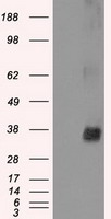 HEK293T cells were transfected with the pCMV6-ENTRY control (Left lane) or pCMV6-ENTRY NEK6 (Right lane) cDNA for 48 hrs and lysed