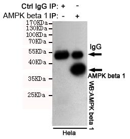 m03741 1 prkab1 primary antiboties ip testing 4