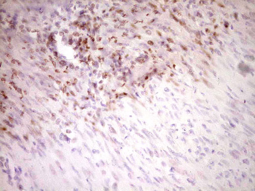 Immunohistochemical staining of paraffin-embedded Human endometrium tissue within the normal limits using anti-STAB2 mouse monoclonal antibody