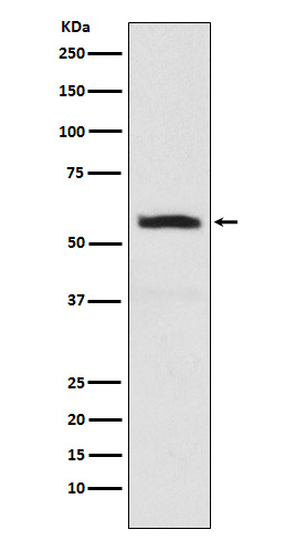 Western blot analysis of alpha Internexin expression in SHSY5Y cell lysate