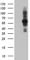 HEK293T cells were transfected with the pCMV6-ENTRY control (Left lane) or pCMV6-ENTRY PDLIM5 (Right lane) cDNA for 48 hrs and lysed