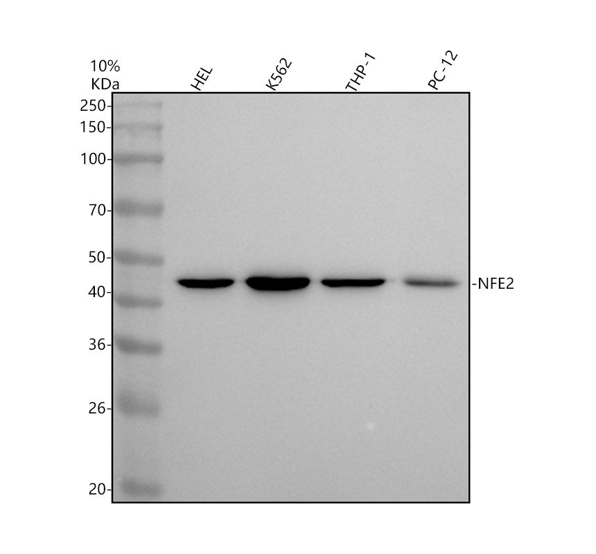 Western blot analysis of NFE2 using anti-NFE2 antibody (M03765)
