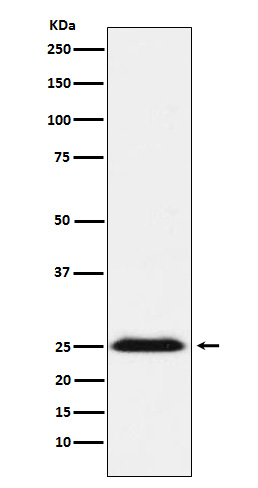 Western blot analysis of BAP31 expression in NCCIT cell lysate