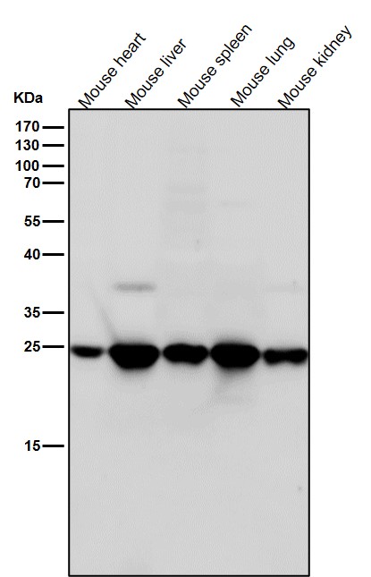 All lanes use the Antibody at 1:4K dilution for 1 hour at room temperature