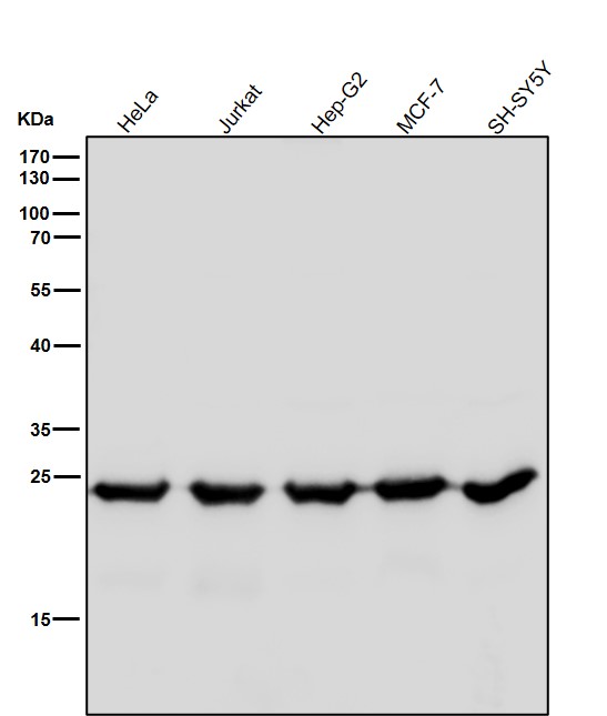 All lanes use the Antibody at 1:4K dilution for 1 hour at room temperature