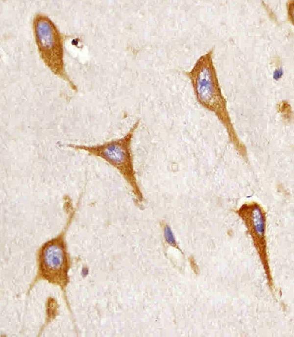 M03767 staining BAP31 in human brain sections by Immunohistochemistry (IHC-P -paraformaldehyde-fixed, paraffin-embedded sections)