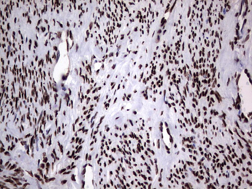m03769 anti hnrnp l hnrnpl mouse monoclonal antibody clone id oti2e4 ihc testing 10