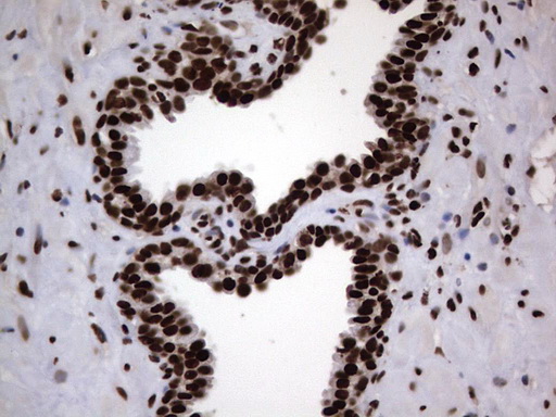 m03769 anti hnrnp l hnrnpl mouse monoclonal antibody clone id oti2e4 ihc testing 11