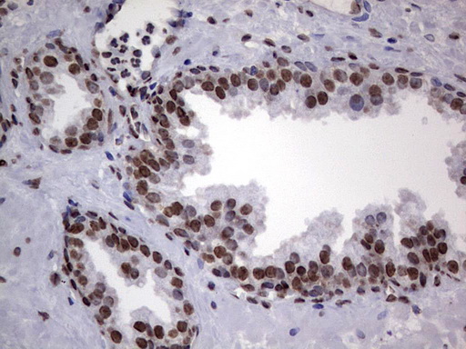 m03769 anti hnrnp l hnrnpl mouse monoclonal antibody clone id oti2e4 ihc testing 12