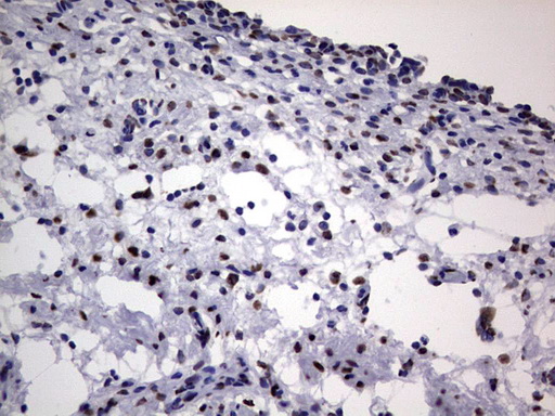 m03769 anti hnrnp l hnrnpl mouse monoclonal antibody clone id oti2e4 ihc testing 13