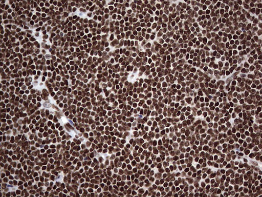 m03769 anti hnrnp l hnrnpl mouse monoclonal antibody clone id oti2e4 ihc testing 14