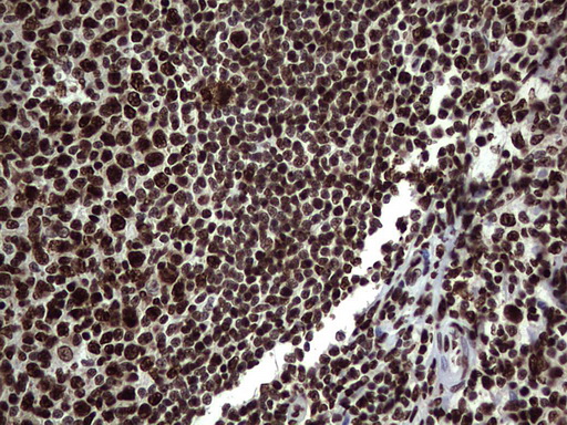 m03769 anti hnrnp l hnrnpl mouse monoclonal antibody clone id oti2e4 ihc testing 15