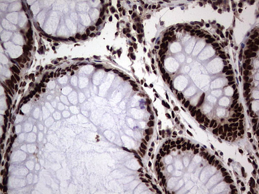 m03769 anti hnrnp l hnrnpl mouse monoclonal antibody clone id oti2e4 ihc testing 16