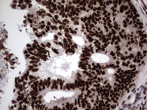 m03769 anti hnrnp l hnrnpl mouse monoclonal antibody clone id oti2e4 ihc testing 17